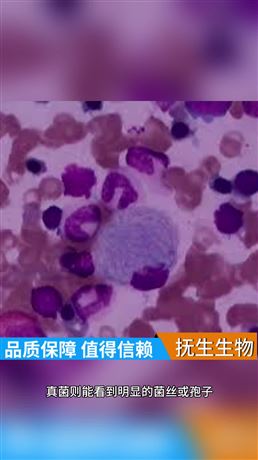 原代細胞培養過程中，如何判斷是否被微生物污染？