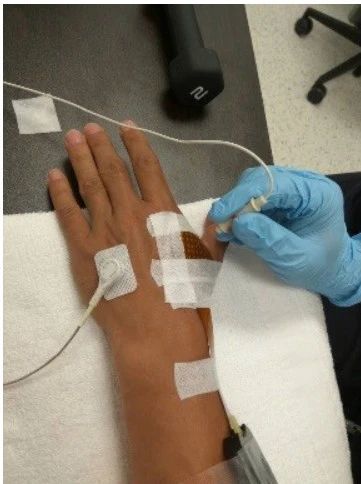 高密度表面肌電分解有多準？雙源驗證告訴你答案